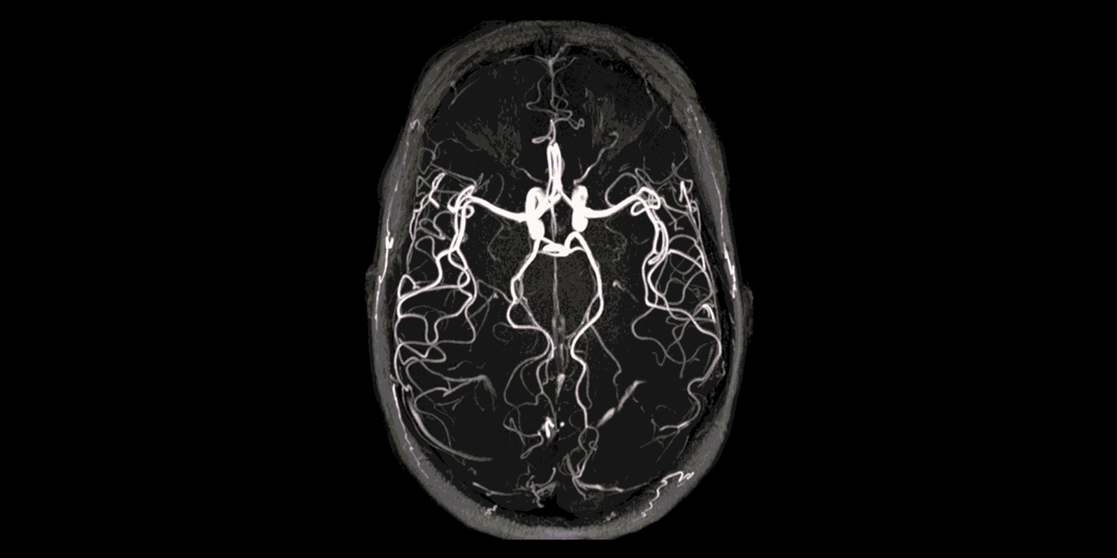 3.19_FEAT_MRI-ANIM2