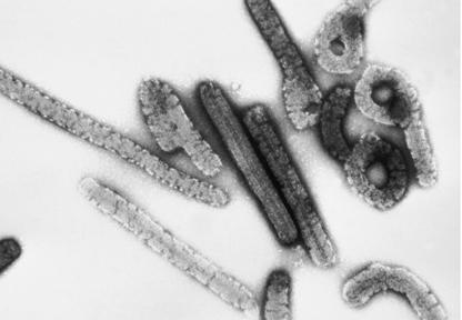 Marburg virus under microscope